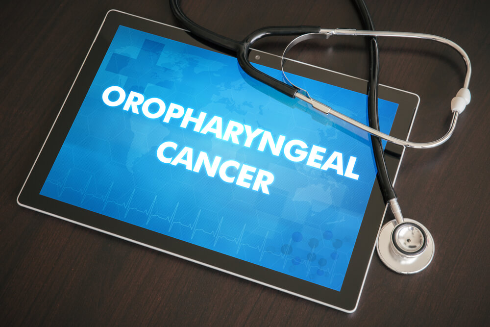 Oropharyngeal cancer (cancer type) diagnosis medical concept on tablet screen with stethoscope.